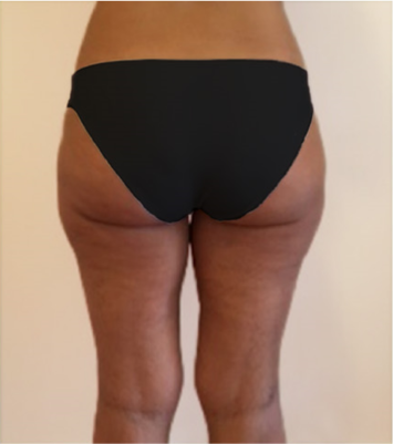 imagen de resultados despues