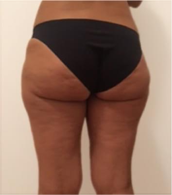 imagen de resultado antes